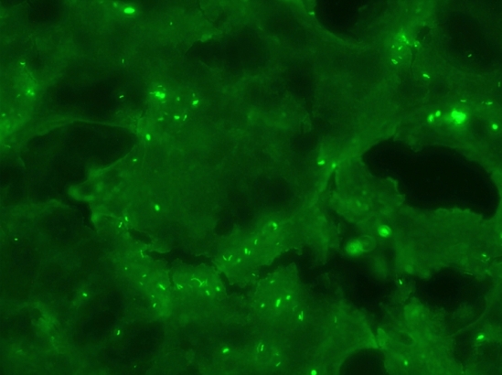 Fluorescent microscope image of a rabies-positive brain sample showing the virus as small green fluorescent clusters